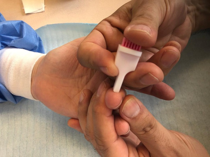 Els membres de totes les llars seleccionats per a l'estudi de prevelancia de l'Covid-19 se sotmetran a dos tipus de test serològics
