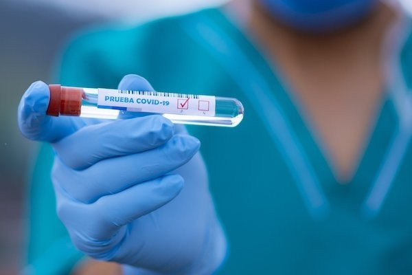 Unint avantatges de la PCR i dels tests ràpids, RAP-ID19 pretén augmentar la fiabilitat dels diagnòstics de COVID-19. /
