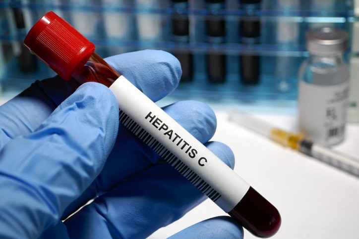 Hepatitis C treatment Hepatitis C - sexually transmitted disease blood test and treatment