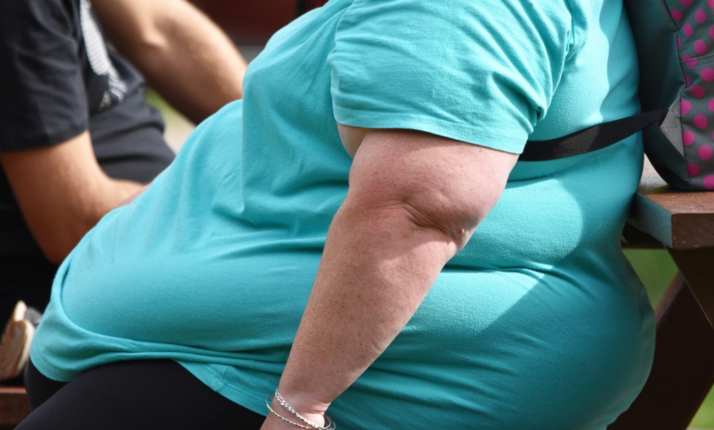 Persona amb obesitat