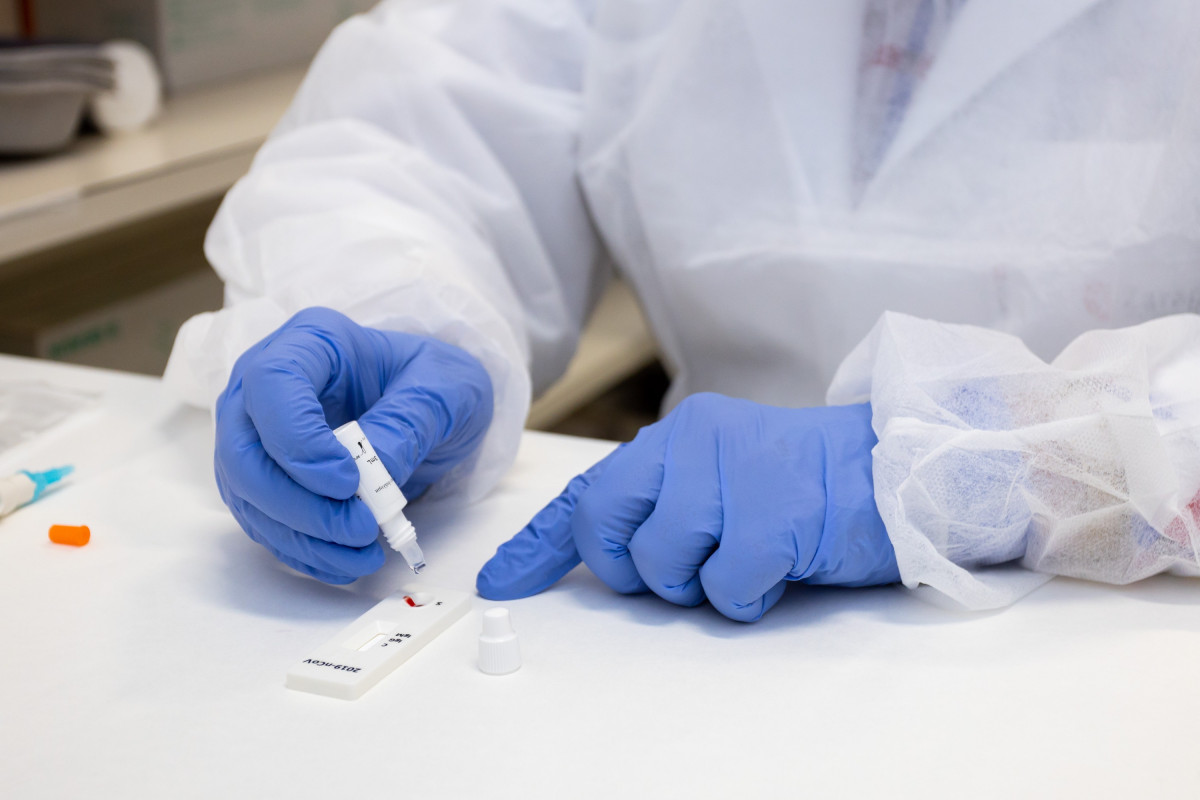 Aragó detecta 429 casos nous de coronavirus procedents de 4.980 PCR.