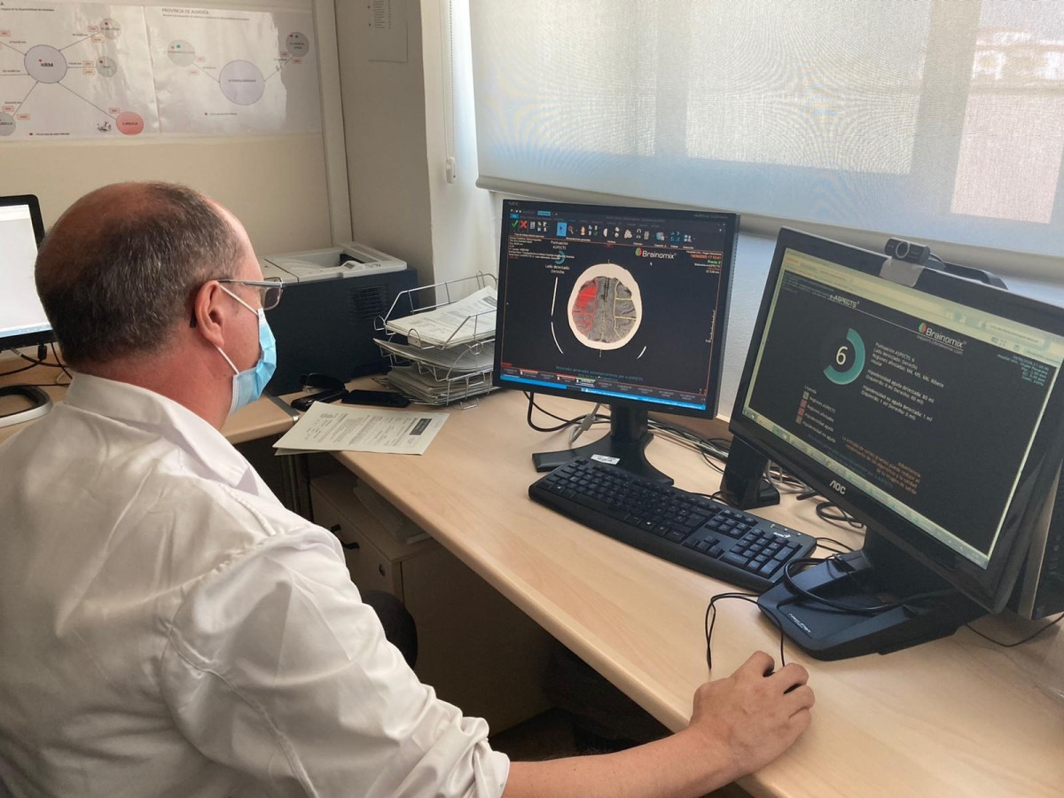 L'Hospital Macarena incorpora un programari de neuroimatge per millorar atenció a l'ictus que ofereix el CATI