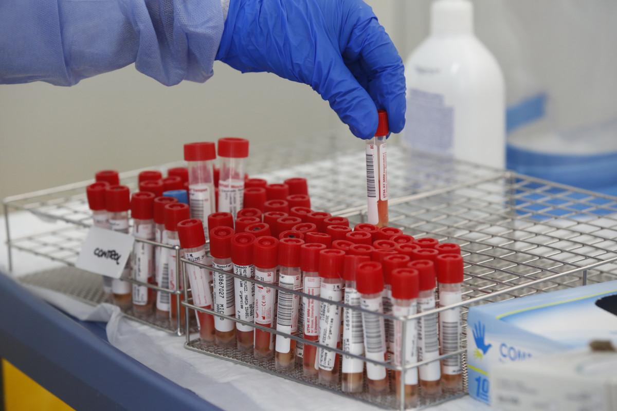 Tubs de proves PCR per a la detecció de l'COVID-19.