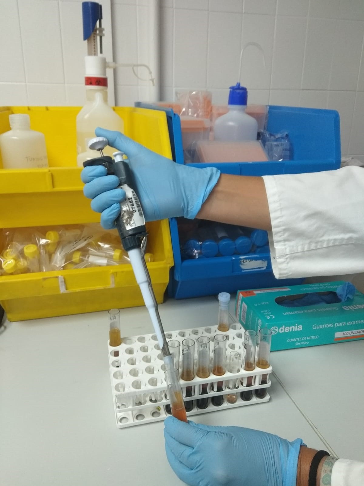 Recerca de cribratge de hipercolesterolèmia en el Macarena