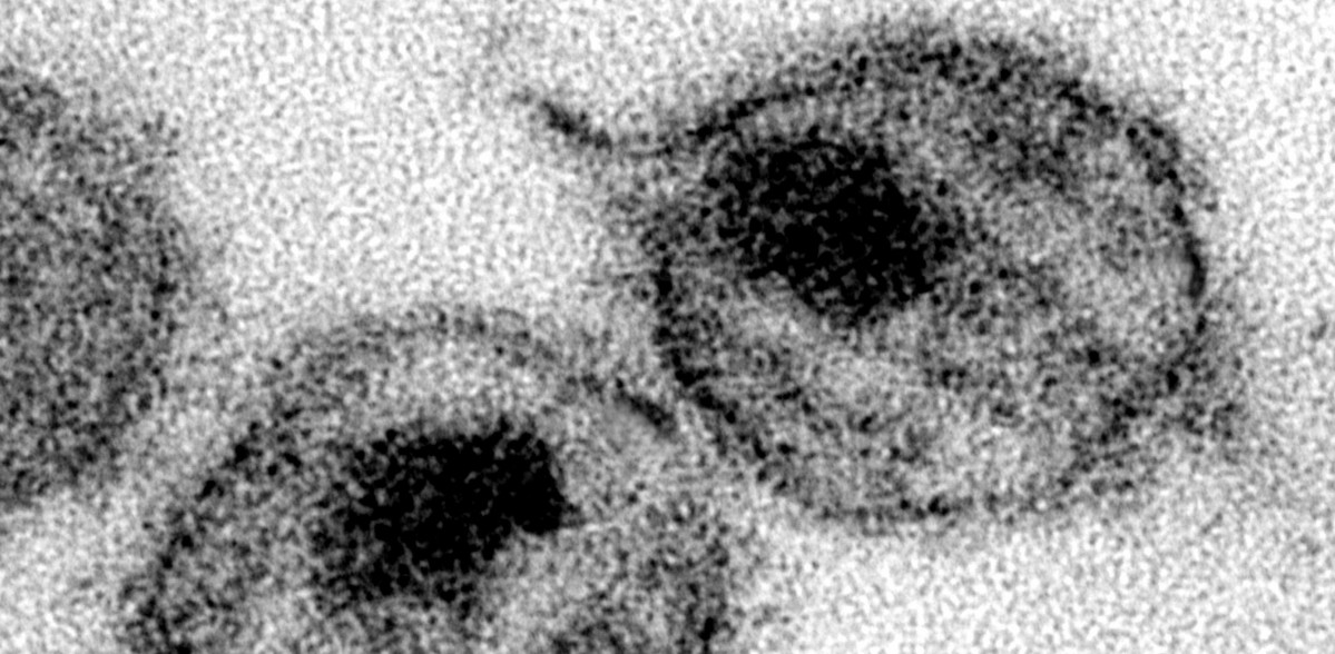 Virus de VIH (imatge d'A Harrison i P. Feorino, de l'USCDCP, via PIxnio).