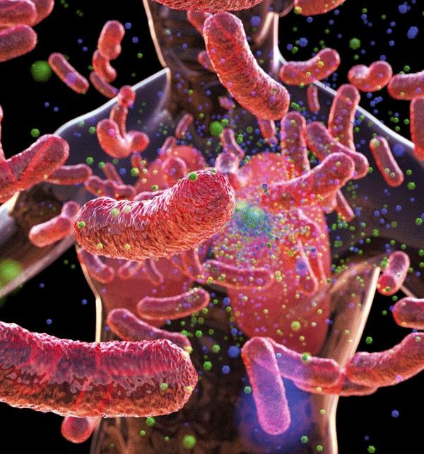 Arxiu - Infecció per tuberculosi