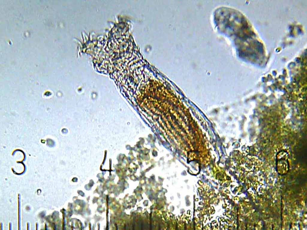 Bdelloid Rotifer