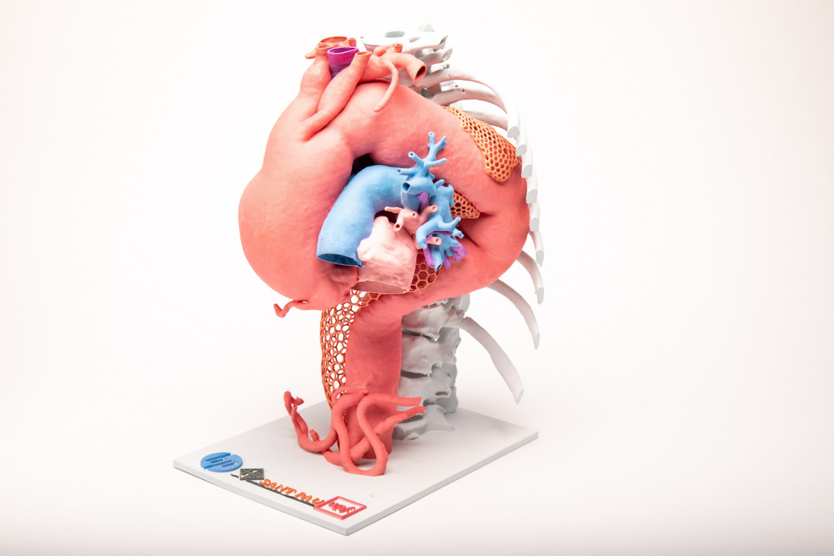 L'exposició '3D Innovació en Medicina' recull un seguit de peces impreses en 3D aplicades a la pràctica assistencial
