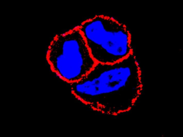 Arxiu - El CSIC evidència que l'ús combinat d'un nou fàrmac millora l'eficiència d'algunes teràpies de càncer de mama