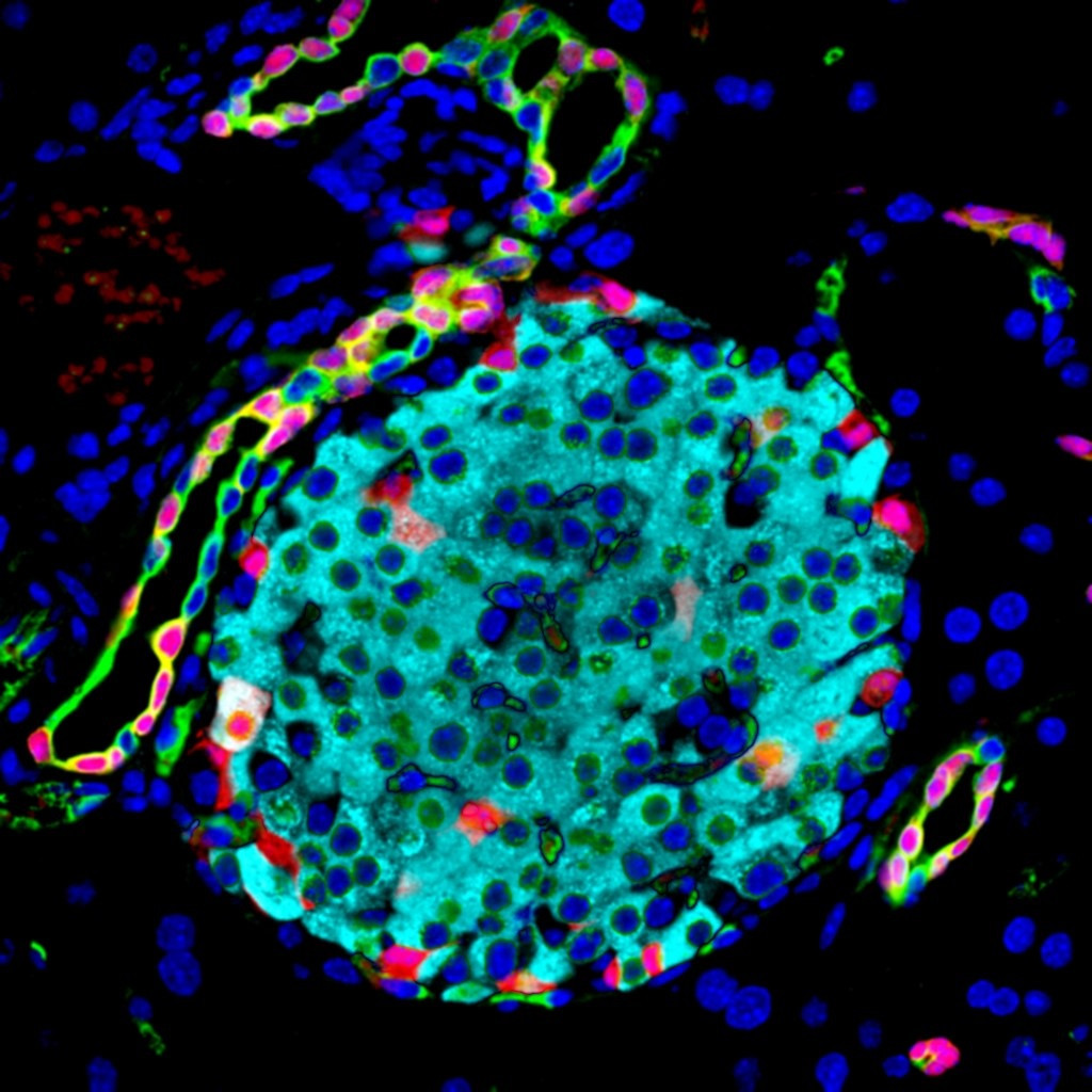 Grupo de células pancreáticas que producen y liberan hormonas que regulan los niveles de glucosa