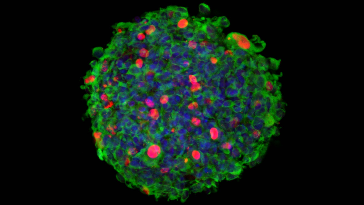 EuropaPress 3982145 imatge 3d immuno microscòpia confocal neuroesfera originada cèl·lules mare