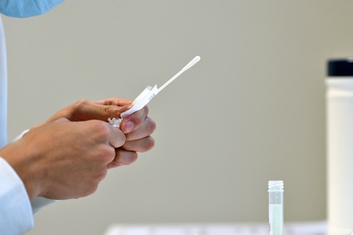 Arxiu - Prova de RT-PCR per a la infecció per SARS-CoV-2.