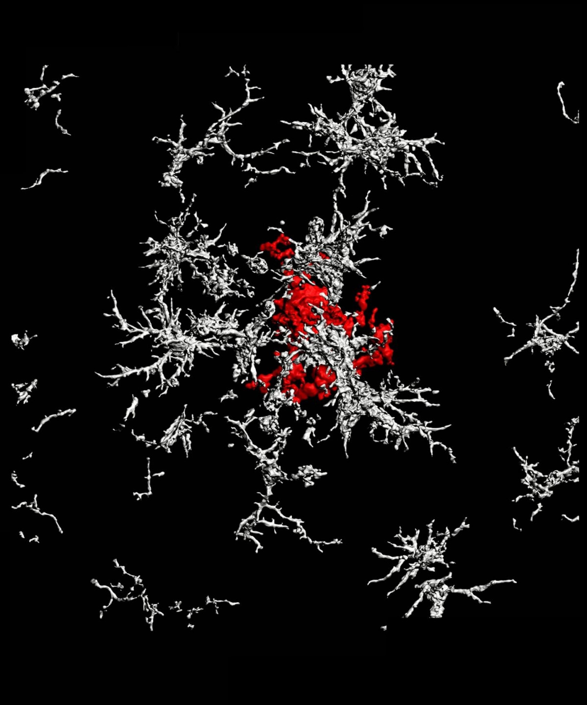 Arxiu - Una placa de beta amiloide de nucli dens (vermell) envoltada de microglia que no té receptors TAM (blanc) en el cervell d'un ratolí amb malaltia d'Alzheimer.
