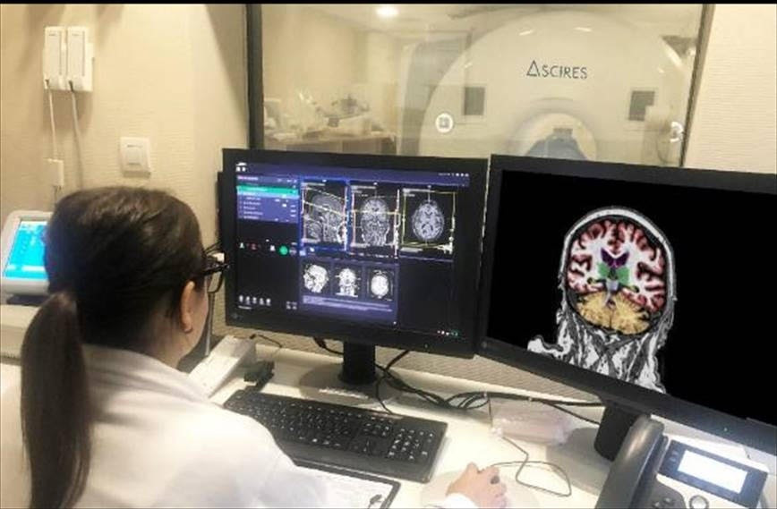 Arxiu - La plataforma calcula volums i realitza tratografies cerebrals, per diagnosticar malalties com l'Alzheimer, la demència, l'epilèpsia o l'esclerosi múltiple.