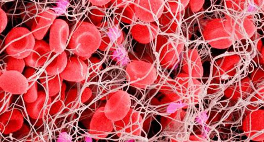 Un equip format per investigadors del Consell Superior d'Investigacions Científiques (CSIC) ha desenvolupat una molècula sintètica senzilla (lligant) que inhibeix l'efecte de l'heparina, el fàrmac anticoagulant més utilitzat, però que